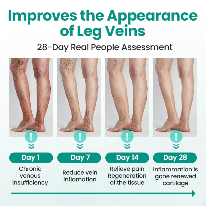 Turmeric Vericose Vein Patch (Pack of 20)